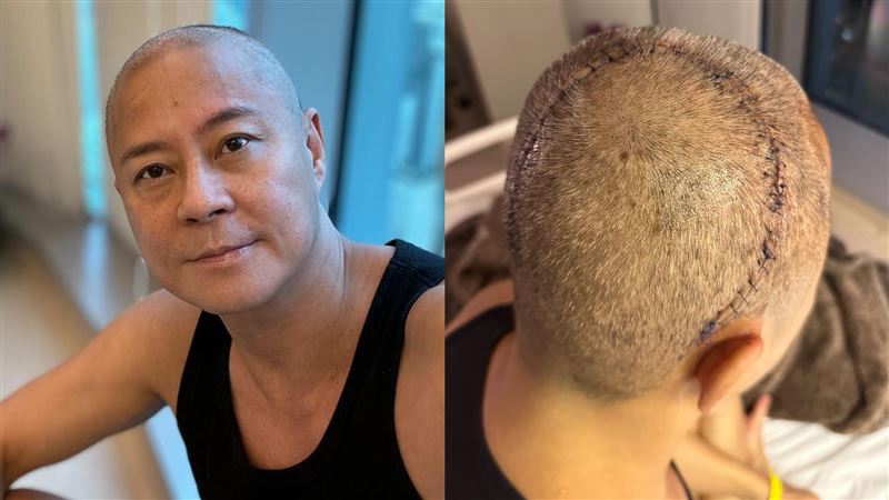 汪明荃步履不穩引網民憂心